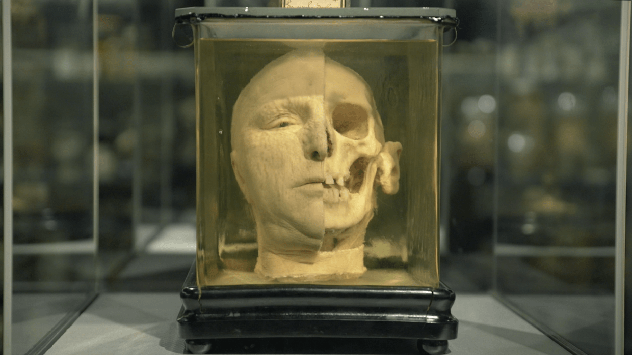 Moet UvA-museum Vrolik naam wijzigen om racistische denkbeelden naamgever?